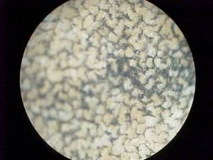 Under the microscope, collotype printing can resemble a bowl of noodles.